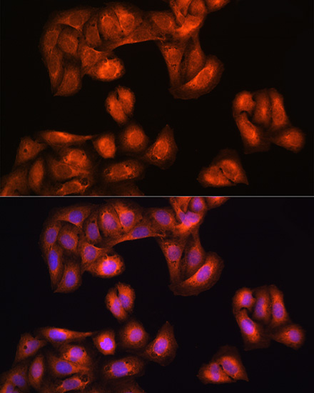 Immunofluorescence analysis of U2OS cells using PHGDH antibody  at dilution of 1:100