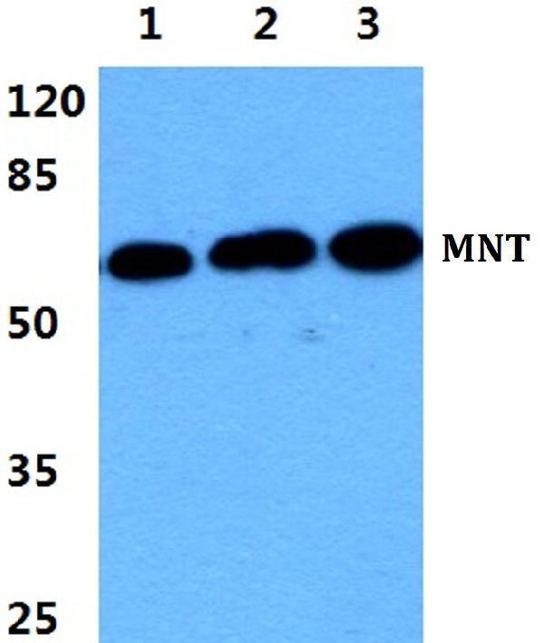 Western blot (WB) analysis of MNT polyclonal antibody at 1:500 dilution
Lane1:MCF-7 cell lysate
Lane2:Raw264