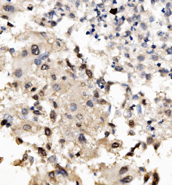 a03357 3 mnt primary antibodies ihc testing 2