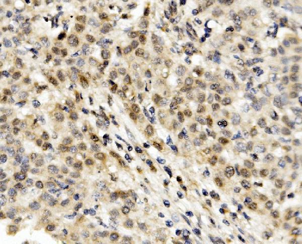 a03357 3 mnt primary antibodies ihc testing 3