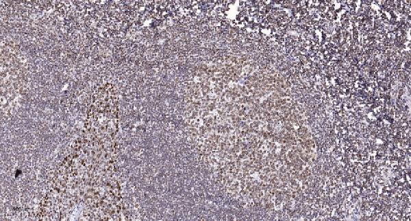 Immunohistochemical analysis of paraffin-embedded human tonsil