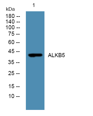Western blot analysis of lysates from SW480 cells, primary antibody was diluted at 1:1000, 4°over night