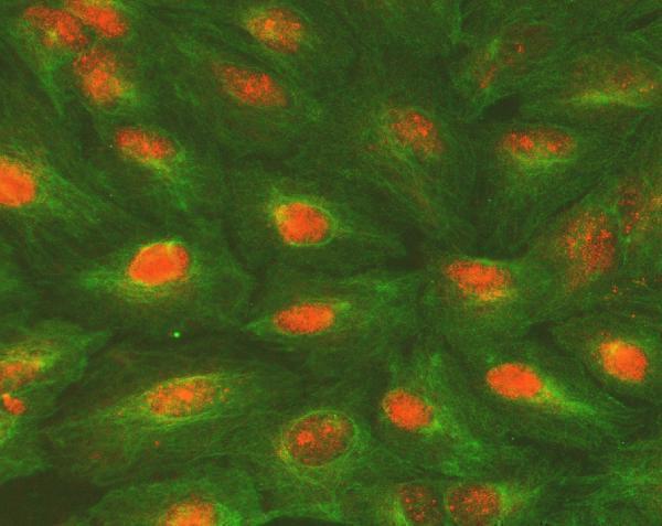  IF analysis of ALKBH5 using anti-ALKBH5 antibody (A03360) and anti-Tubulin Alpha antibody (M03989-3)