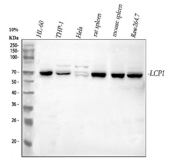 a03361 lcp1 primary antibodies wb testing 1