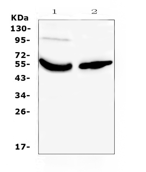 Western blot analysis of Vitamin D Binding protein using anti-Vitamin D Binding protein antibody (A03364-1). Electrophoresis was performed on a 5-20% SDS-PAGE gel at 70V (Stacking gel) / 90V (Resolving gel) for 2-3 hours. The sample well of each lane was loaded with 50ug of sample under reducing conditions. Lane 1: human placenta tissue lysates, Lane 2: human A431 whole cell lysates. After Electrophoresis, proteins were transferred to a Nitrocellulose membrane at 150mA for 50-90 minutes. Blocked the membrane with 5% Non-fat Milk/ TBS for 1.5 hour at RT. The membrane was incubated with rabbit anti-Vitamin D Binding protein antigen affinity purified polyclonal antibody (Catalog # A03364-1) at 0.5 ug/mL overnight at 4 then washed with TBS-0.1%Tween 3 times with 5 minutes each and probed with a goat anti-rabbit IgG-HRP secondary antibody at a dilution of 1:10000 for 1.5 hour at RT. The signal is developed using an Enhanced Chemiluminescent detection (ECL) kit (Catalog # EK1002) with Tanon 5200 system. A specific band was detected for Vitamin D Binding protein at approximately 53KD. The expected band size for Vitamin D Binding protein is at 53KD.