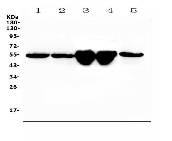  Western blot analysis of Gc using anti-Gc antibody (A03364-2)