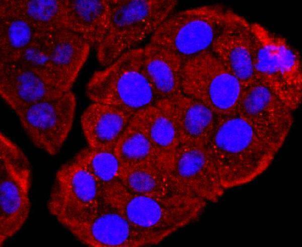 ICC staining DBP in Hela cells (red)