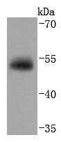 Western blot analysis of DBP on human lung lysates using anti- DBP antibody at 1/1,000 dilution