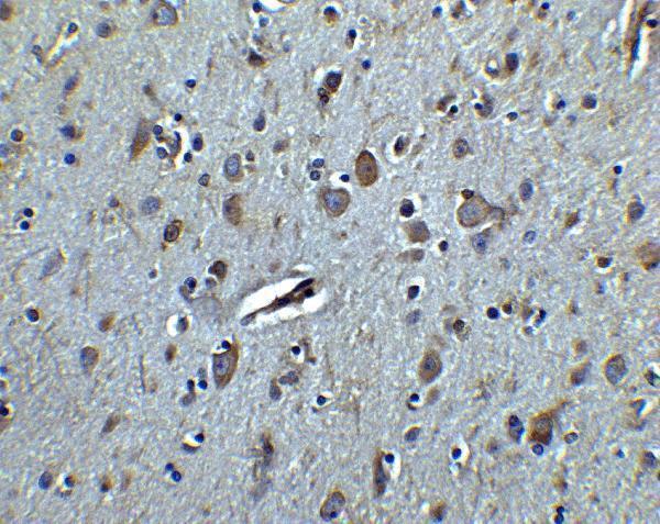 a03371 tet3 primary antibodies ihc testing 2