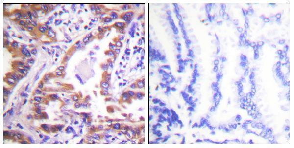 a03372 1 canx primary antibodies if testing 15