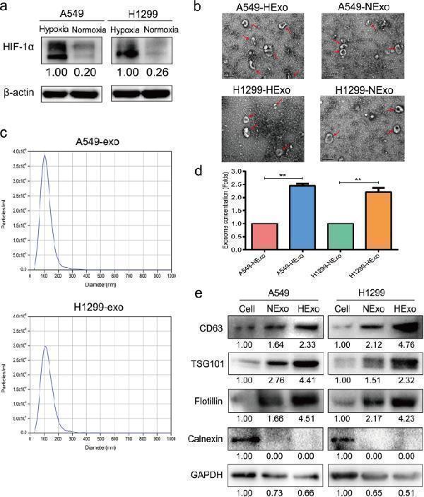 Characterization of exosomes derived from LUAD cells