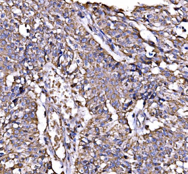  IHC analysis of Calnexin/CANX using anti-Calnexin/CANX antibody (A03372-2)