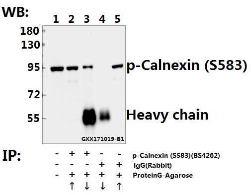 Immunoprecipitation of L02 whole cell lysate using Calnexin (phospho-S583) pAb (Sepharose Bead Conjugate) #BD0047(lane 2 and lane 3) and Nonspecific IgG  Control (Sepharose Bead Conjugate)#BD0047 (lane 4 and lane 5 ) 