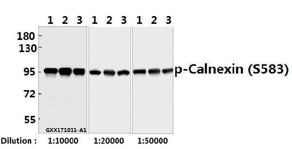 Western blot (WB) analysis of Calnexin (phospho-S583) pAb at 1:10000 to 1:50000 dilution
Lane1:HEK293T whole cell lysate(40ug)
Lane2:SGC7901 whole cell lysate(40ug)
Lane3:A375 whole cell lysate(40ug)