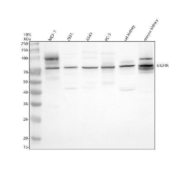Western blot analysis of SIGIRR using anti-SIGIRR antibody (A03373-2)