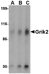 Western blot analysis of Grik2 in human brain tissue lysate with Grik2 antibody at (A) 0