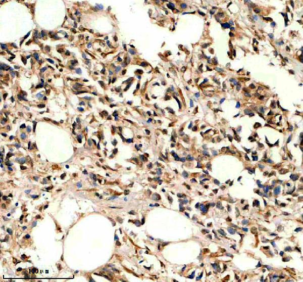 a03377 1 ighmbp2 primary antibodies ihc testing 1