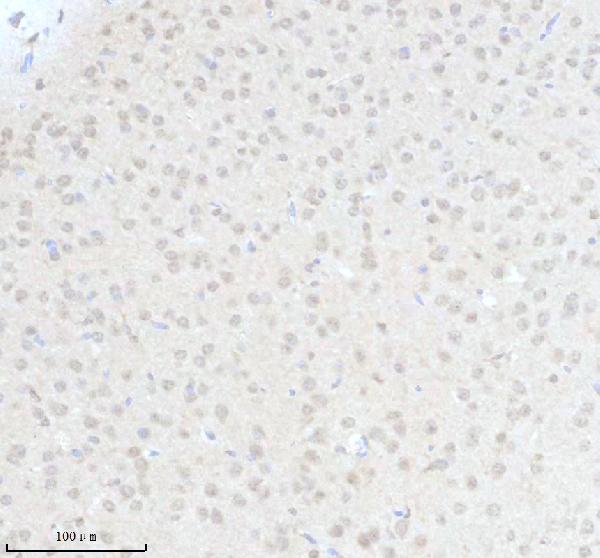 a03377 1 ighmbp2 primary antibodies ihc testing 2
