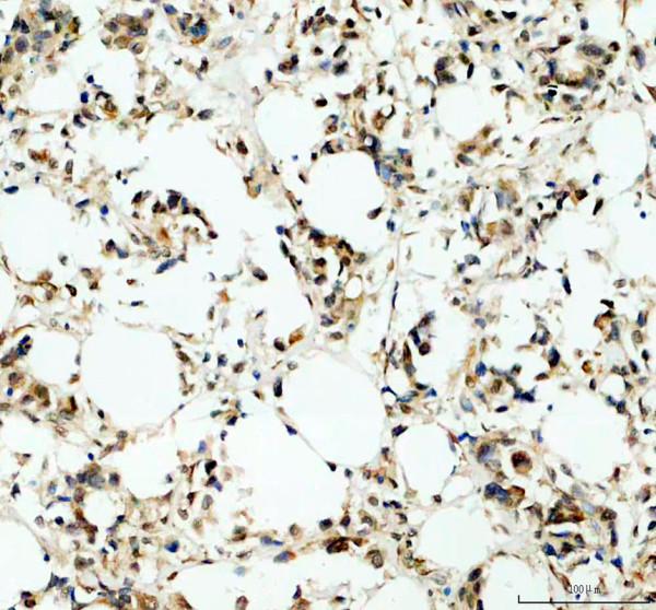 a03377 1 ighmbp2 primary antibodies ihc testing 2_1