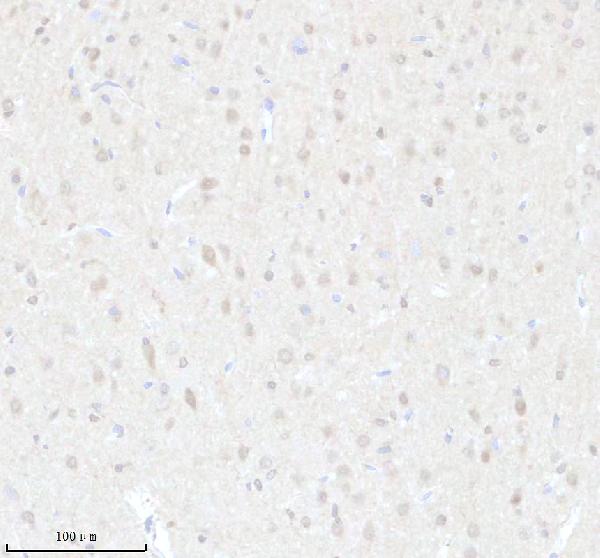 a03377 1 ighmbp2 primary antibodies ihc testing 3