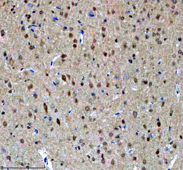 a03377 1 ighmbp2 primary antibodies ihc testing 3_1