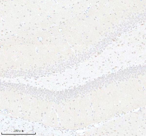a03377 1 ighmbp2 primary antibodies ihc testing 4