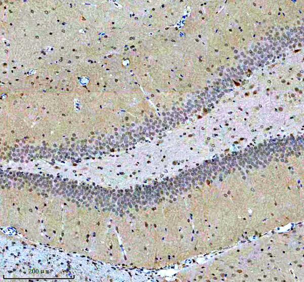 a03377 1 ighmbp2 primary antibodies ihc testing 4_1
