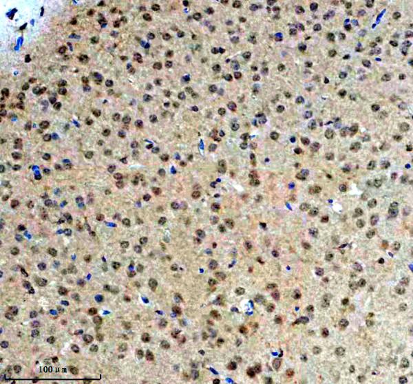 a03377 1 ighmbp2 primary antibodies ihc testing 5