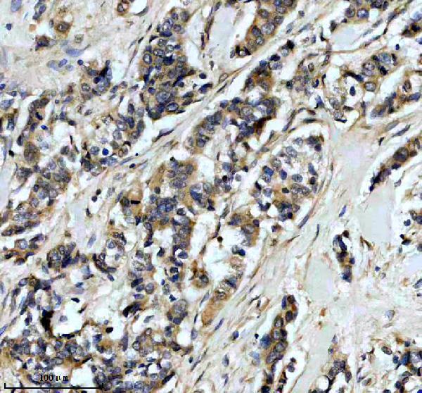 a03378 1 epb41l3 primary antibodies ihc testing 1