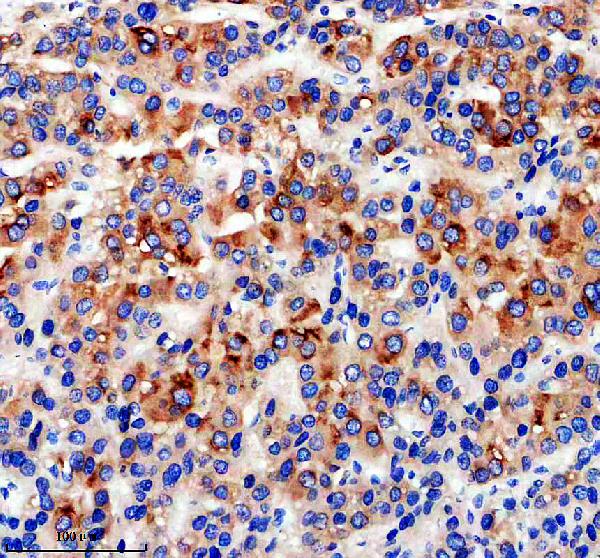 a03382 1 gabarapl1 primary antibodies ihc testing 1