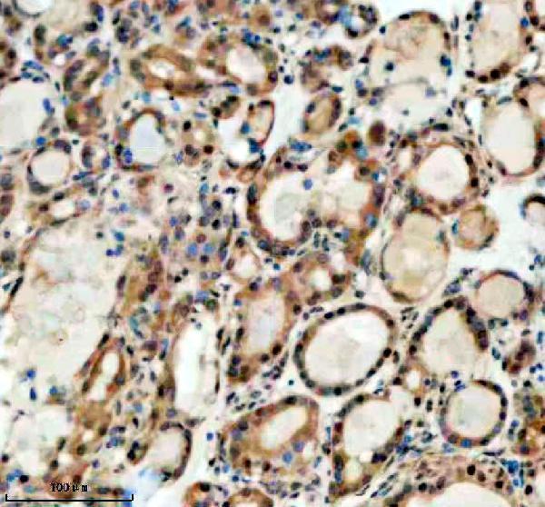 IHC analysis of SMARCAL1 using anti-SMARCAL1 antibody (A03383-2)