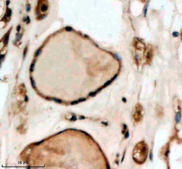 IHC analysis of SMARCAL1 using anti-SMARCAL1 antibody (A03383-2)