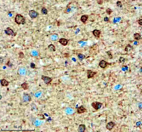 a03383 2 smarcal1 primary antibodies ihc testing 3