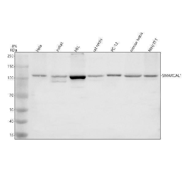 Western blot analysis of SMARCAL1 using anti-SMARCAL1 antibody (A03383-2)