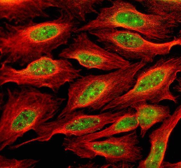 a03387 1 npat primary antibodies if testing 1