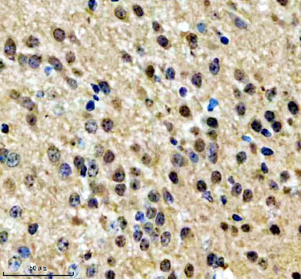 a03387 1 npat primary antibodies ihc testing 1