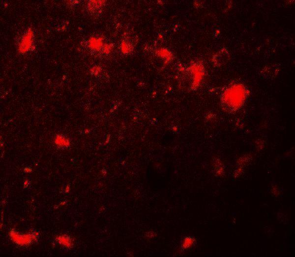 Immunofluorescence of CBX4 in human brain tissue with CBX4 antibody at 20 μg/mL