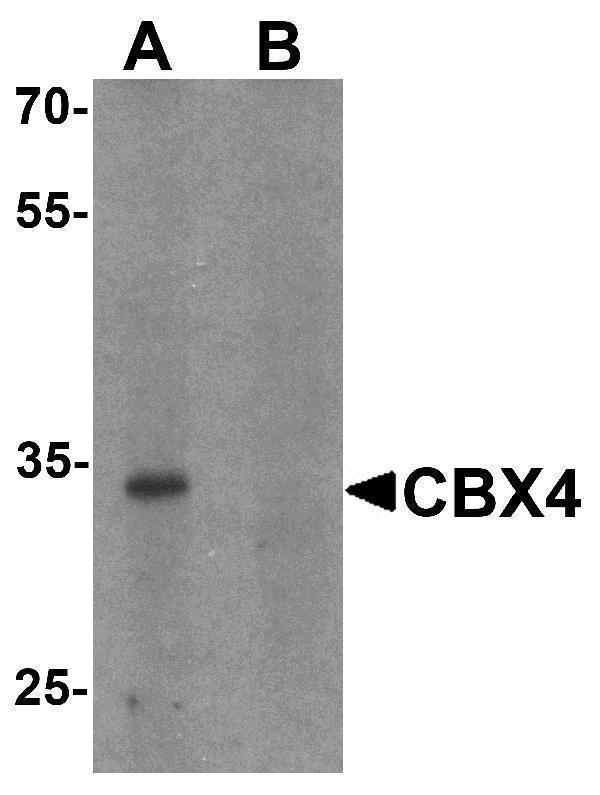 Western blot analysis of CBX4 in human brain tissue lysate with CBX4 antibody at 1 μg/ml in (A) the absence and (B) the presence of blocking peptide