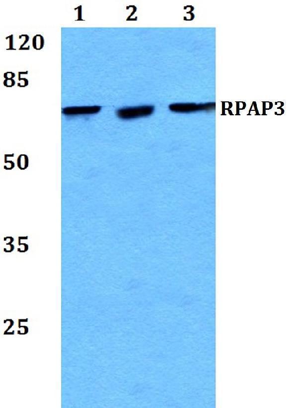 Western blot (WB) analysis of RPAP3 polyclonal antibody at 1:500 dilution
Lane1:Jurkat whole cell lysate
Lane2:Raw264