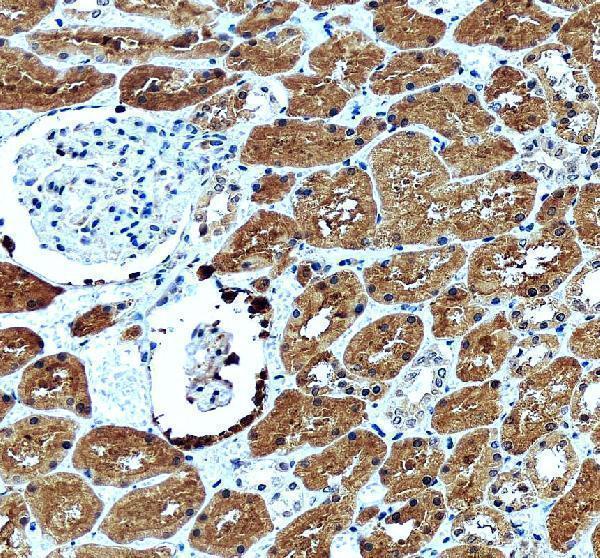 IHC analysis of GLRX using anti-GLRX antibody (A03392-1)