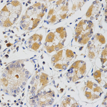 a03392 glrx primary antiboties ihc testing 2