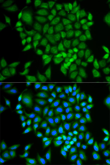 a03392 glrx primary antiboties ihc testing 3