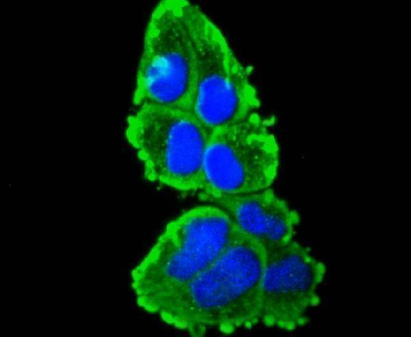 ICC staining Cytokeratin 16 in Hela cells (green)