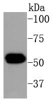 Western blot analysis of Cytokeratin 16 on human skin lysates using anti-Cytokeratin 16 antibody at 1/1,000 dilution