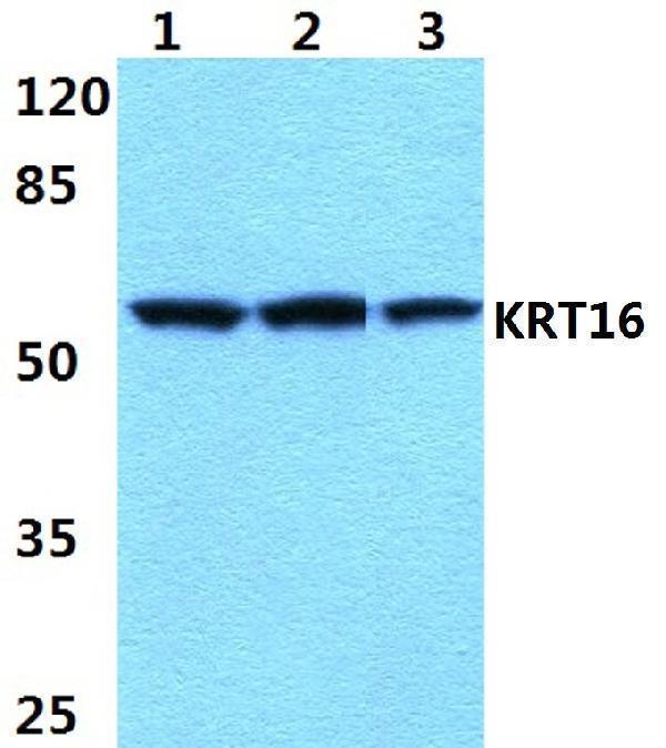 Western blot (WB) analysis of Cytokeratin 16 (S451) polyclonal antibody at 1:500 dilution
Lane1:MCF-7 cell lysate 
Lane2:sp2/0 cell lysate
Lane3:PC12 cell lysate