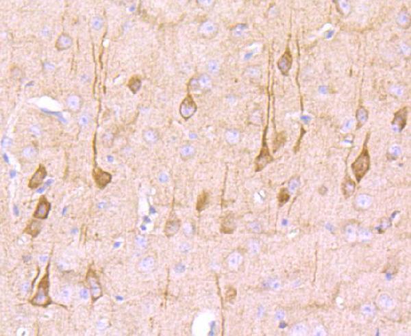 a03394 1 cspg4 primary antiboties ihc testing 2