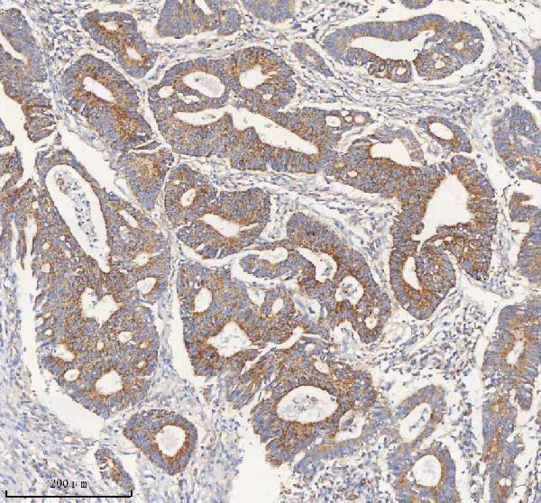  IHC analysis of PCCA using anti-PCCA antibody (A03395-1)