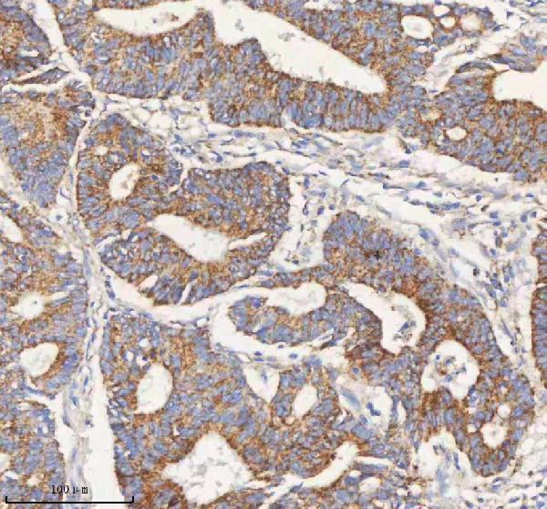  IHC analysis of PCCA using anti-PCCA antibody (A03395-1)