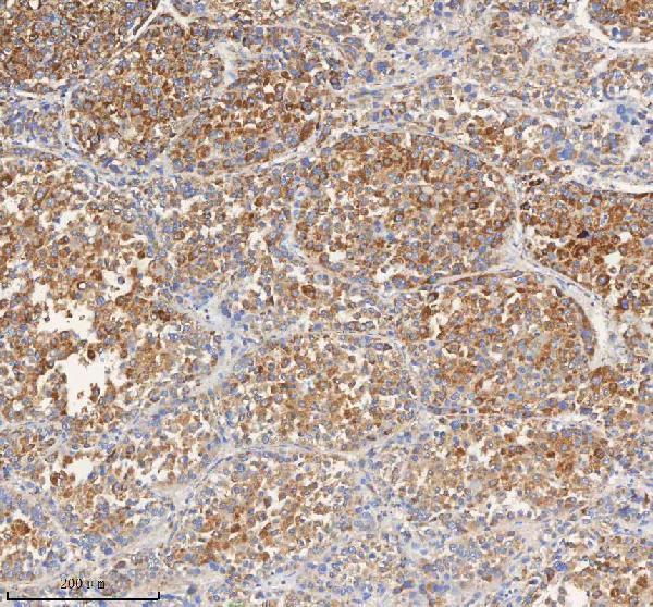 a03395 1 pcca primary antibodies ihc testing 4