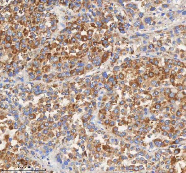 a03395 1 pcca primary antibodies ihc testing 5